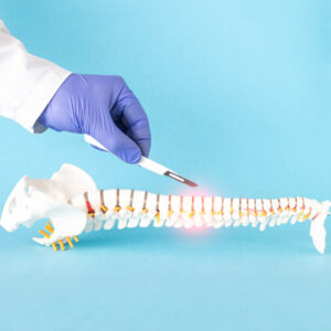 Spinal Decompression vs Surgery: Which Treatment Is Right for You?