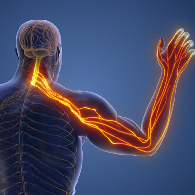 Can a Chiropractor Help a Pinched Nerve?