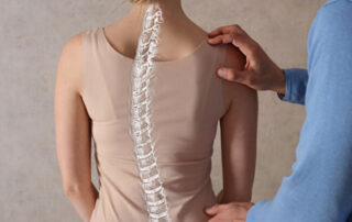 Scoliosis Chiropractor